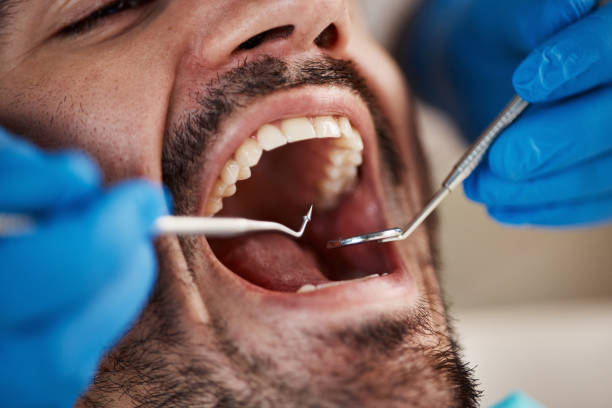Best Walk-In Emergency Dental Services in Estacada, OR